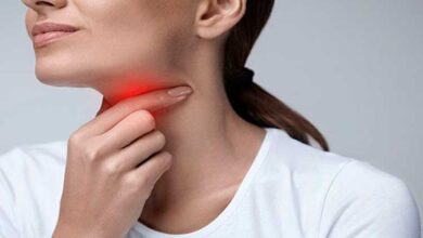 تورم غدد لنفاوی