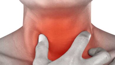 غدد لنفاوی گردن