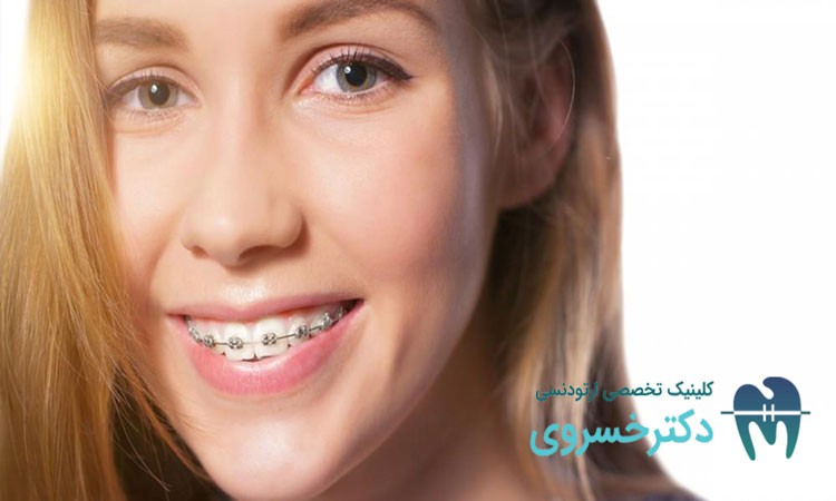 اهداف ارتودنسی دندان برای کودکان و بزرگسالان
