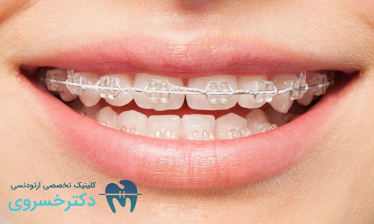 ارتودنسی با چه اهدافی انجام می شود؟